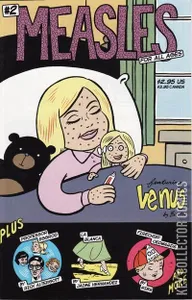 Measles #2