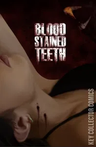 Blood-Stained Teeth #1