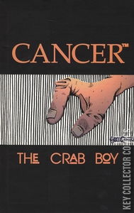 Cancer: The Crab Boy